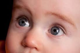 الجلوكوما الخلقية لدى الاطفال